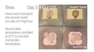 Foam Dressing Comparison  ALLEVYN◊ Life vs MepilexTM Border [upl. by Eibmab]