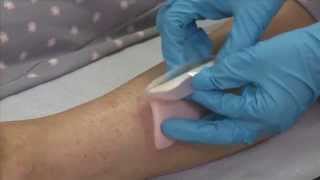 ALLEVYN Adhesive application to the leg [upl. by Lyrehs791]