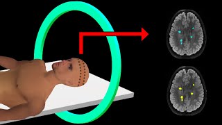 PET Scan  How It Works  Animation [upl. by Caughey]