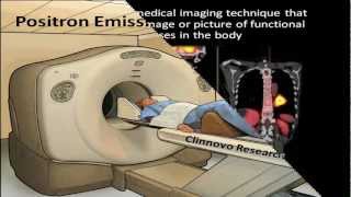 PET Positron Emission Tomography [upl. by Nilpik]