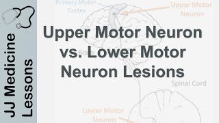 Rh incompatibility and Hemolytic disease of the newborn HDN [upl. by Stanzel480]