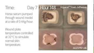 Foam Dressing Comparison  ALLEVYN◊ Life vs AquacelTM Foam [upl. by Hadihahs]